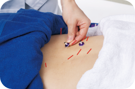 症状の鑑別・施術（整体・鍼灸）