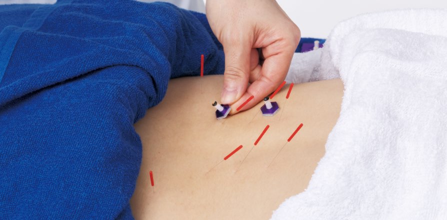 鍼灸治療